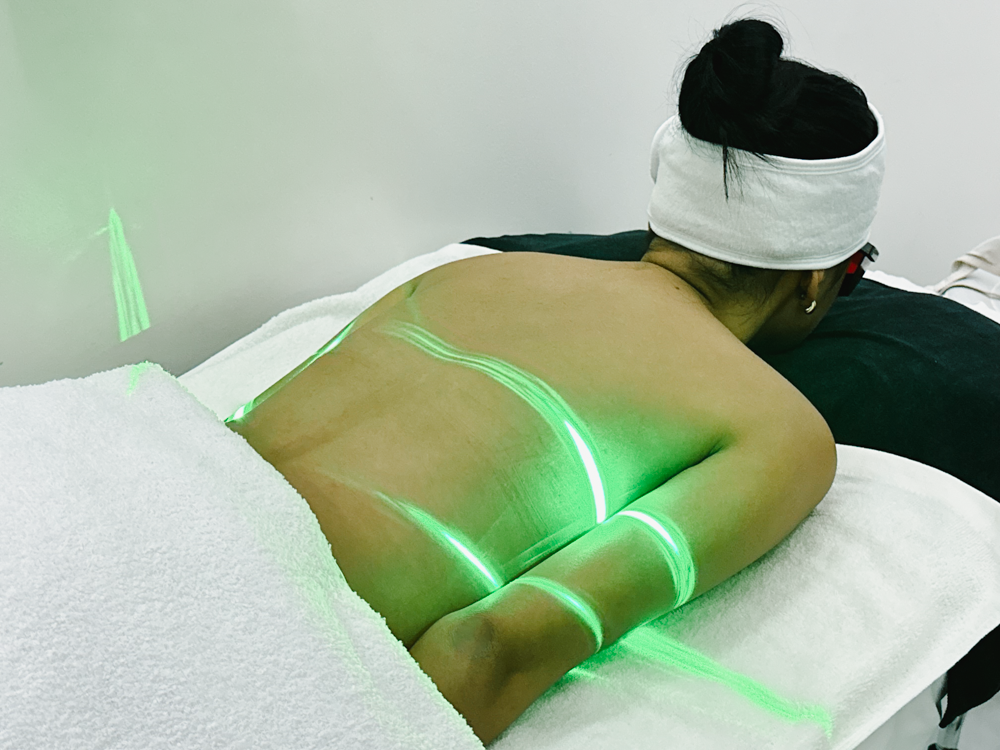 Emerald Laser Lipo